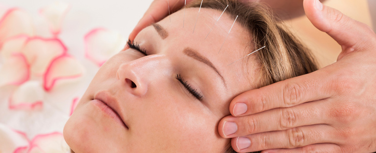 Acupuncture Provides True Pain Relief in Study-0